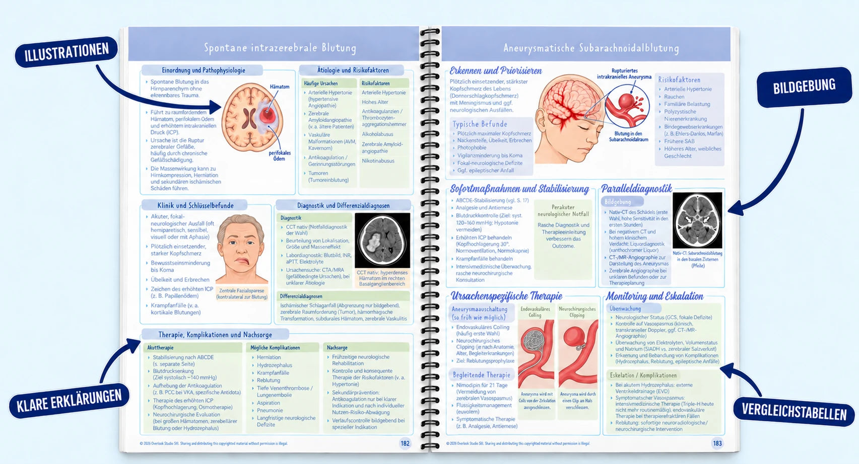 Doppelseite zu intrazerebraler Blutung und Subarachnoidalblutung mit Illustrationen, Erklärungen, Bildgebung und Vergleichstabellen